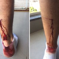 Imagem referente a Internauta afirma que também foi atacado por Pitbull no Bairro Neva