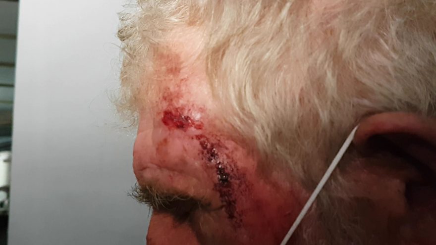 Idoso de 65 anos é agredido pela namorada, que tem 38 anos, e caso vai parar na delegacia