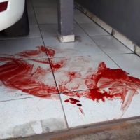 Homem fica gravemente ferido ao ser atingido por três tiros em Cascavel Imagem referente a Homem fica gravemente ferido ao ser atingido por três tiros em Cascavel