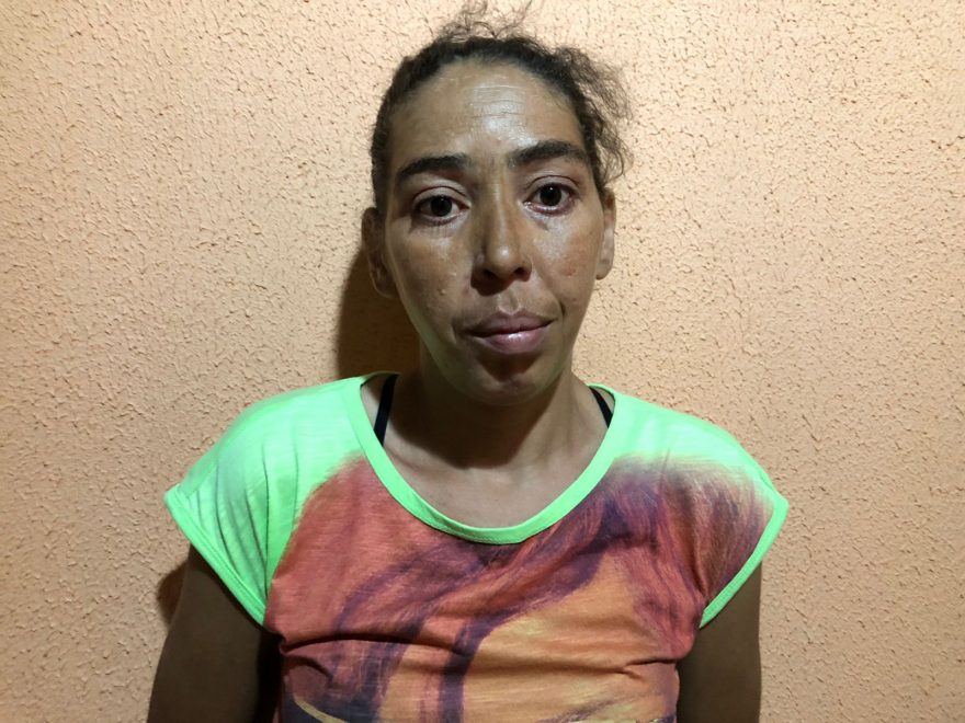 “Ele colocou esparadrapo e disse que ia sarar”, diz mulher com o dedo quebrado há mais de um mês