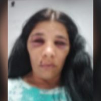 Imagem referente a Vítima de agressão consegue mandar foto e áudios para familiares