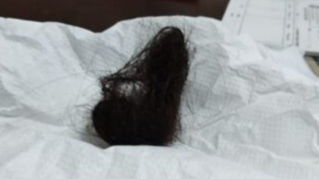 Filha arranca cabelo da mãe após briga em Apucarana