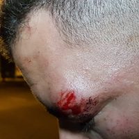 Imagem referente a Rapaz relata ter sido agredido em boteco na Rua Paraná