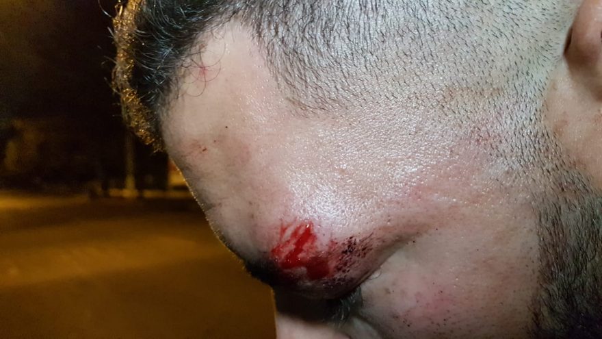 Rapaz relata ter sido agredido em boteco na Rua Paraná