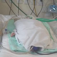 Após apelo de pai, bebê diagnosticado com broncopneumonia é transferido para uma UTI Pediátrica Imagem referente a Após apelo de pai, bebê diagnosticado com broncopneumonia é transferido para uma UTI Pediátrica