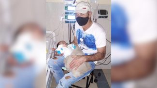 Criança com broncopneumonia tem melhora significativa e respira sem aparelhos
