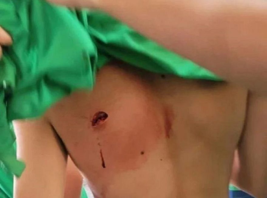 Vídeo mostra briga em escola que terminou com aluno esfaqueado