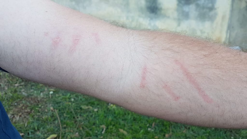 Após ser agredido por mulher, homem vem até Cascavel para registrar boletim de ocorrência