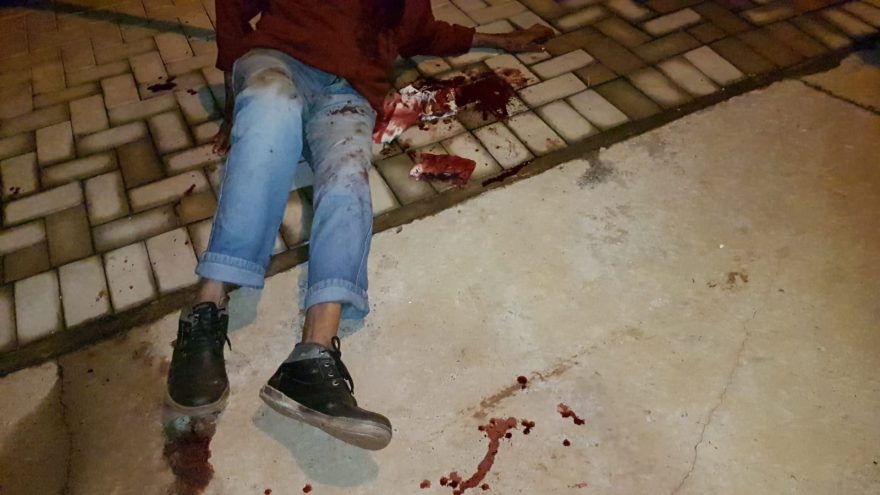 Idoso perde muito sangue após cair e bater o nariz no chão, no Bairro Veneza