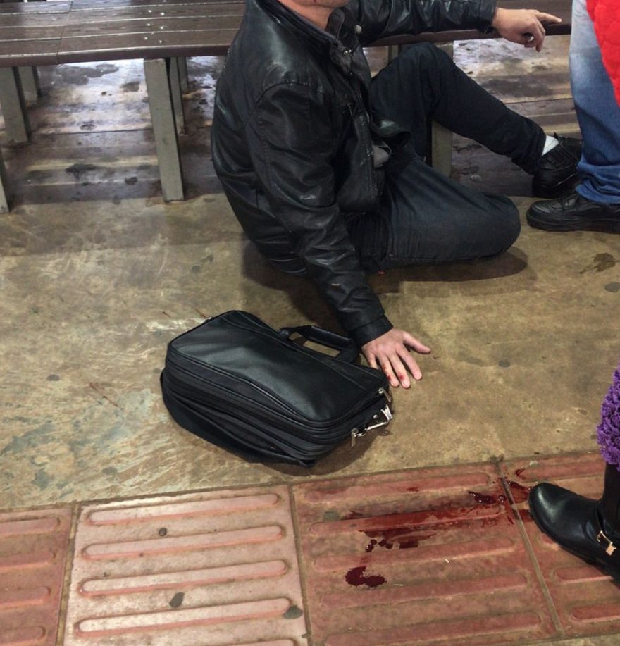 Homem sofre queda no Terminal Leste e sofre contusão na cabeça