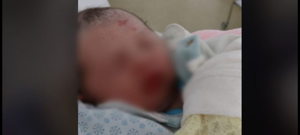 Bebê nasce com símbolo da cruz na testa; bisavó que faleceu costumava fazer o sinal nos netos
