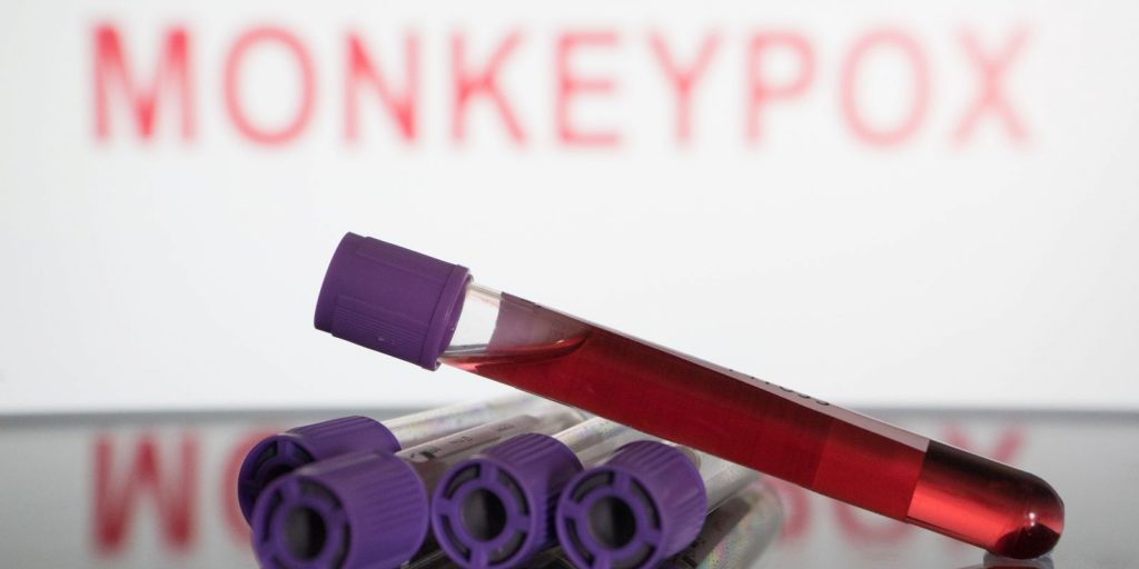 11º caso de monkeypox é confirmado em Cascavel