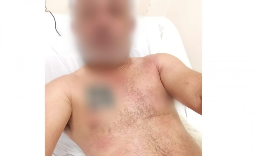 Paciente do HU alega ter apresentado reação alérgica após ser medicado