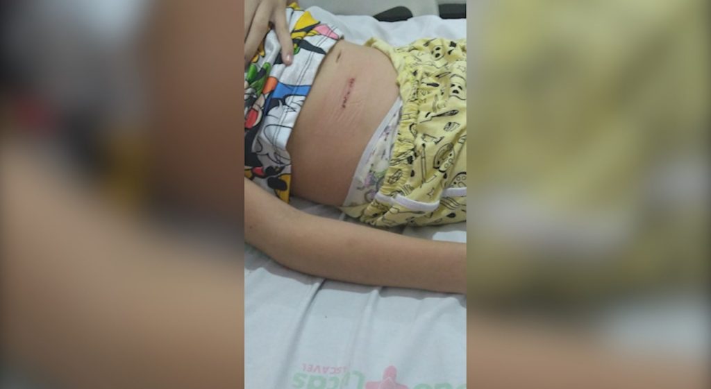 Mãe pede ajuda para pagar a cirurgia de apêndice da pequena Lauani, de 10 anos; entenda o caso