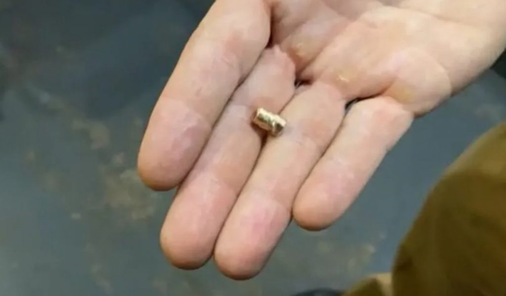 Homem sobrevive após levar tiro na nuca que saiu pela boca