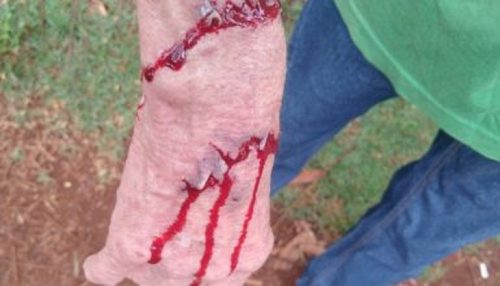 Cães soltos nas ruas? Saiba o que a Prefeitura orienta ser feito Imagem referente a Cães soltos nas ruas? Saiba o que a Prefeitura orienta ser feito