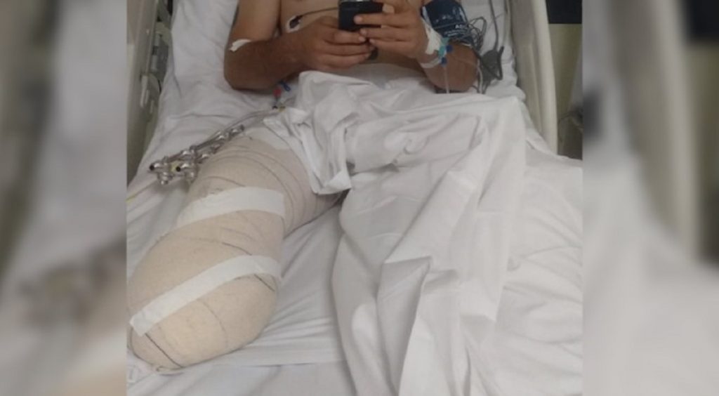 Jovem que foi prensado por carro no Parque São Paulo precisa amputar o pé Jovem que foi prensado por carro no Parque São Paulo precisa amputar o pé