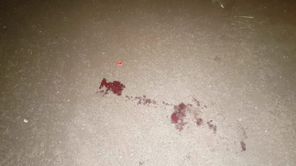 Homem é atendido pelo Siate após sofrer queda de bicicleta no bairro Morumbi