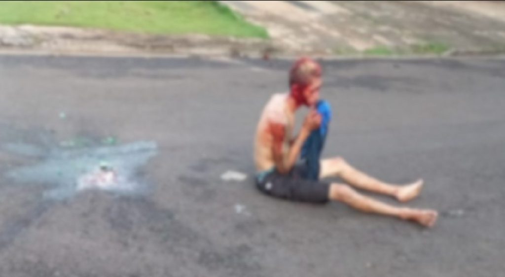 Homem leva garrafada na cabeça durante agressões e é socorrido pelo Corpo de Bombeiros no Brasília Homem leva garrafada na cabeça durante agressões e é socorrido pelo Corpo de Bombeiros no Brasília
