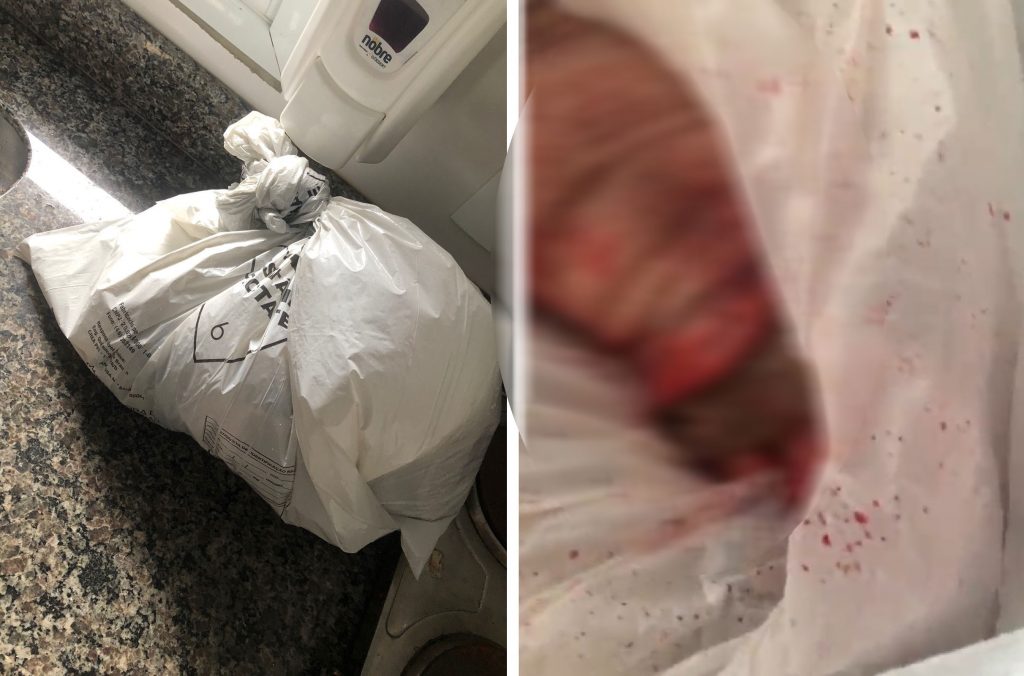 Segundo Acesc, após descuido, pé amputado foi deixado em local inapropriado