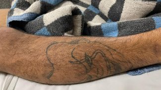 Jovem que foi baleado no Floresta e morreu no HUOP é identificado como Dheiverson Kauan Barbosa dos Santos, 21 anos