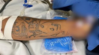 Baleado na cabeça morre no hospital sem identificação