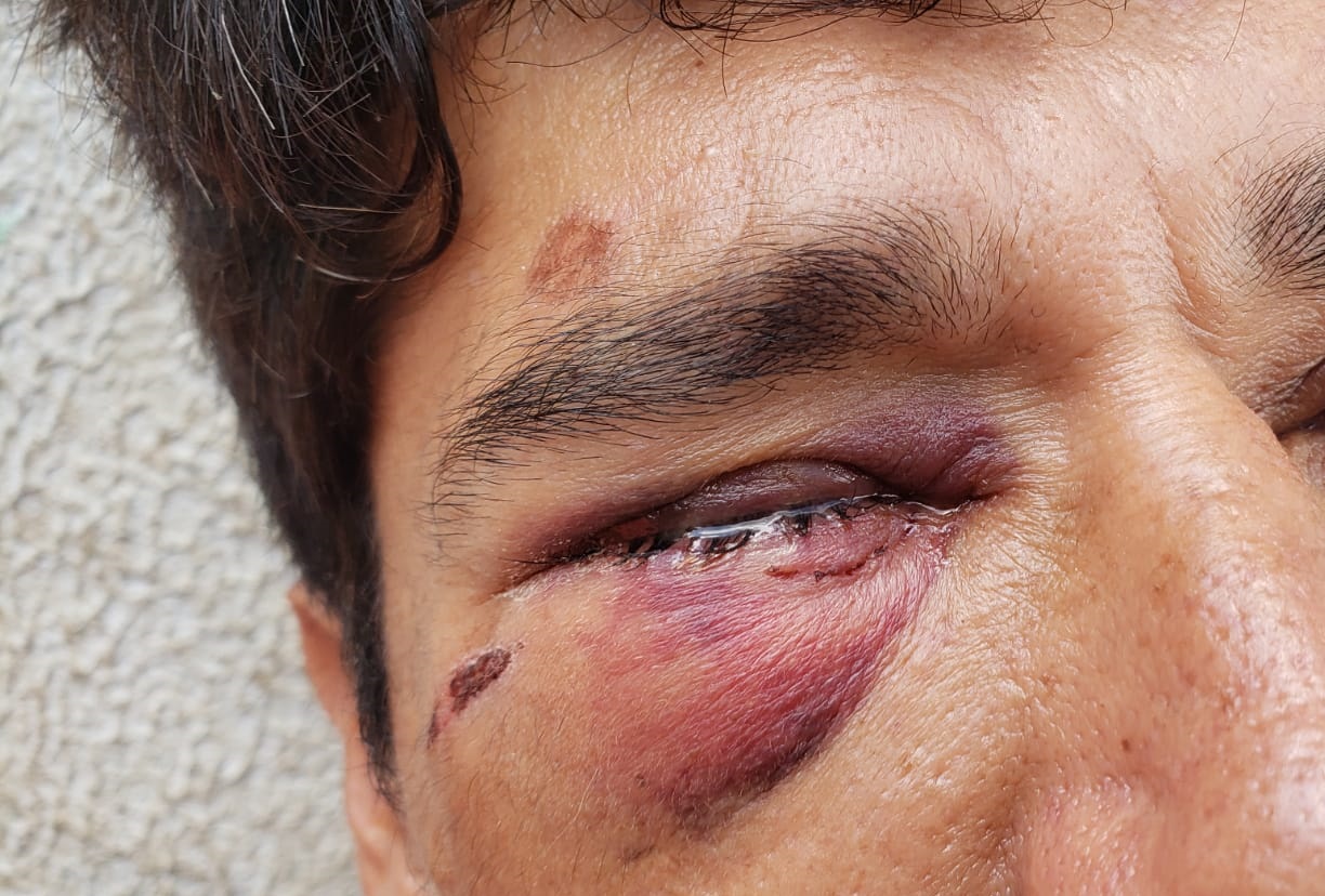 Secretário defende abordagem da GM em situação em que homem foi agredido com arma de fogo e taser