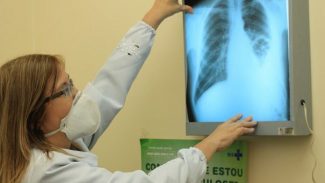 Conselho aprova novas diretrizes para tratamento da tuberculose no SUS