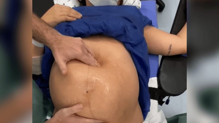 Vídeo de bebê sendo virado na barriga antes do parto impressiona internautas