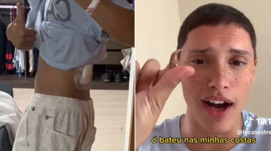 Jovem relata ter levado tiro enquanto dormia e brinca: ‘Tô blindadão’