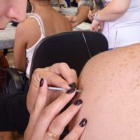 Paraná forma primeira turma de médicos para atuar com acupuntura no SUS