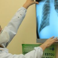 Brasil instala comitê interministerial para eliminação da tuberculose 