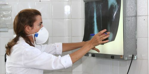 Imagem referente a Governo cria comitê para reduzir casos de tuberculose até 2030