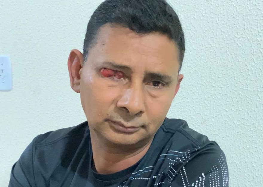 Paciente com câncer no olho está há mais de um ano na fila de espera por cirurgia e pede ajuda