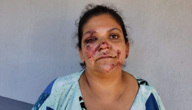 Imagem referente a Mulher que foi jogada para fora de carro em movimento pelo marido fala sobre momentos de terror