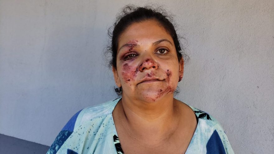 Mulher que foi jogada para fora de carro em movimento pelo marido fala sobre momentos de terror