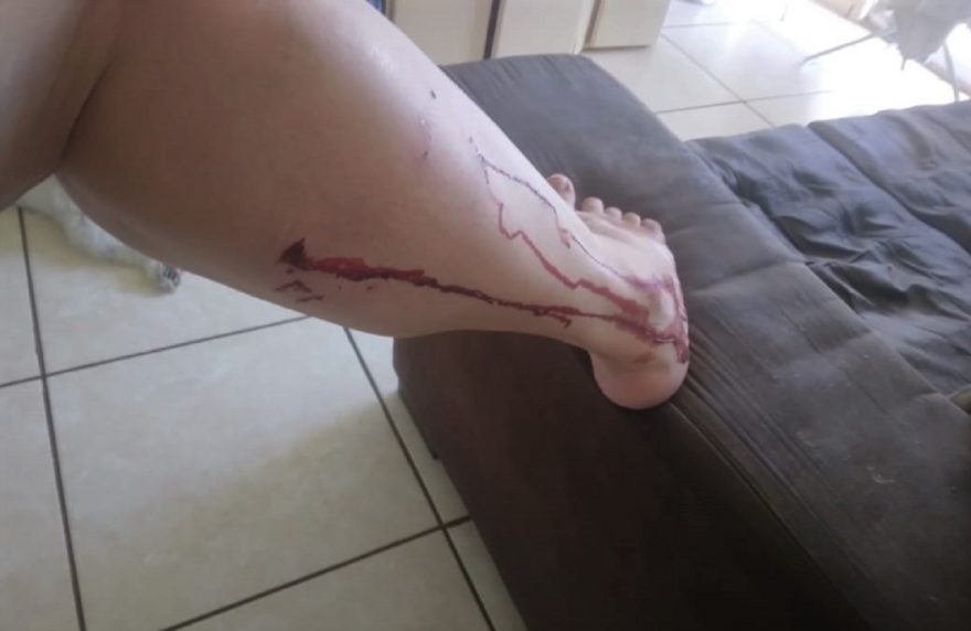 Moradora do Conjunto Riviera pede providências após ser novamente atacada por cachorro