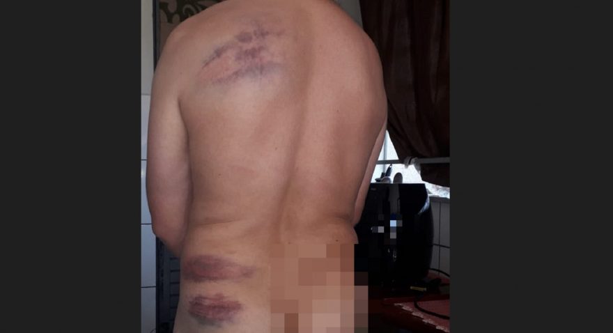 Internauta relata ter sido espancado por policiais militares ao procurar ajuda em UPS Norte
