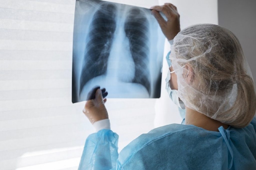 Cascavel deve gastar R$ 760 mil na contratação de serviço em Radiologia para as Upas Cascavel deve gastar R$ 760 mil na contratação de serviço em Radiologia para as Upas