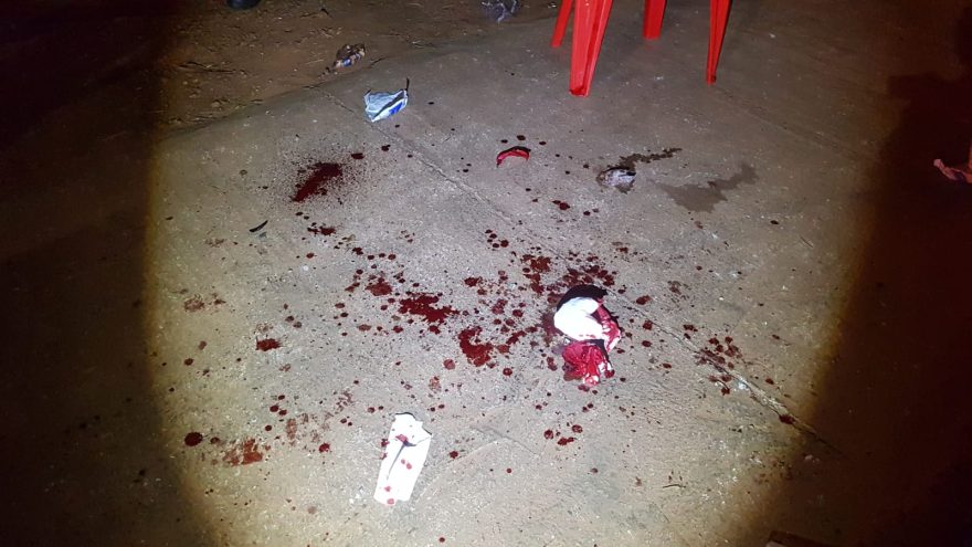 Mulher sofre ferimentos na cabeça ao ser agredida na Estrada Rio da Paz