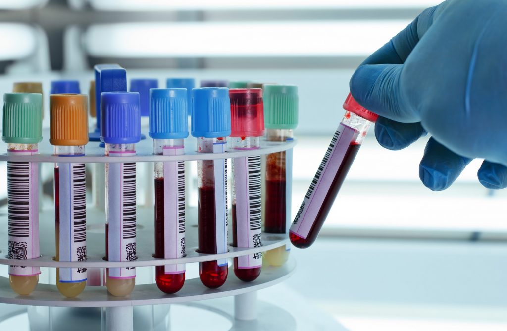 Município investe quase R$ 6,5 milhões em exames bioquímicos