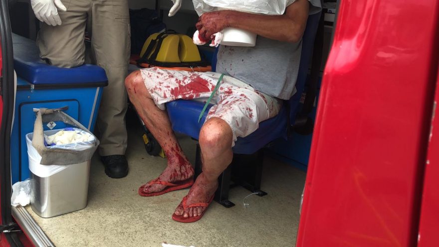 Todo ensanguentado, homem é socorrido pelo Siate após levar paulada na cabeça