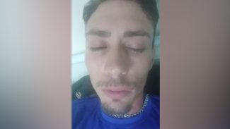 Com fratura na perna, jovem pede ajuda para fazer cirurgia após acidente no Bairro Canadá
