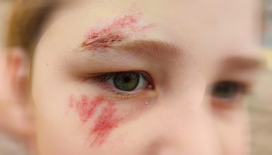 Imagem referente a Mãe pede atitude da direção de escola municipal após filho ter sido agredido por colega