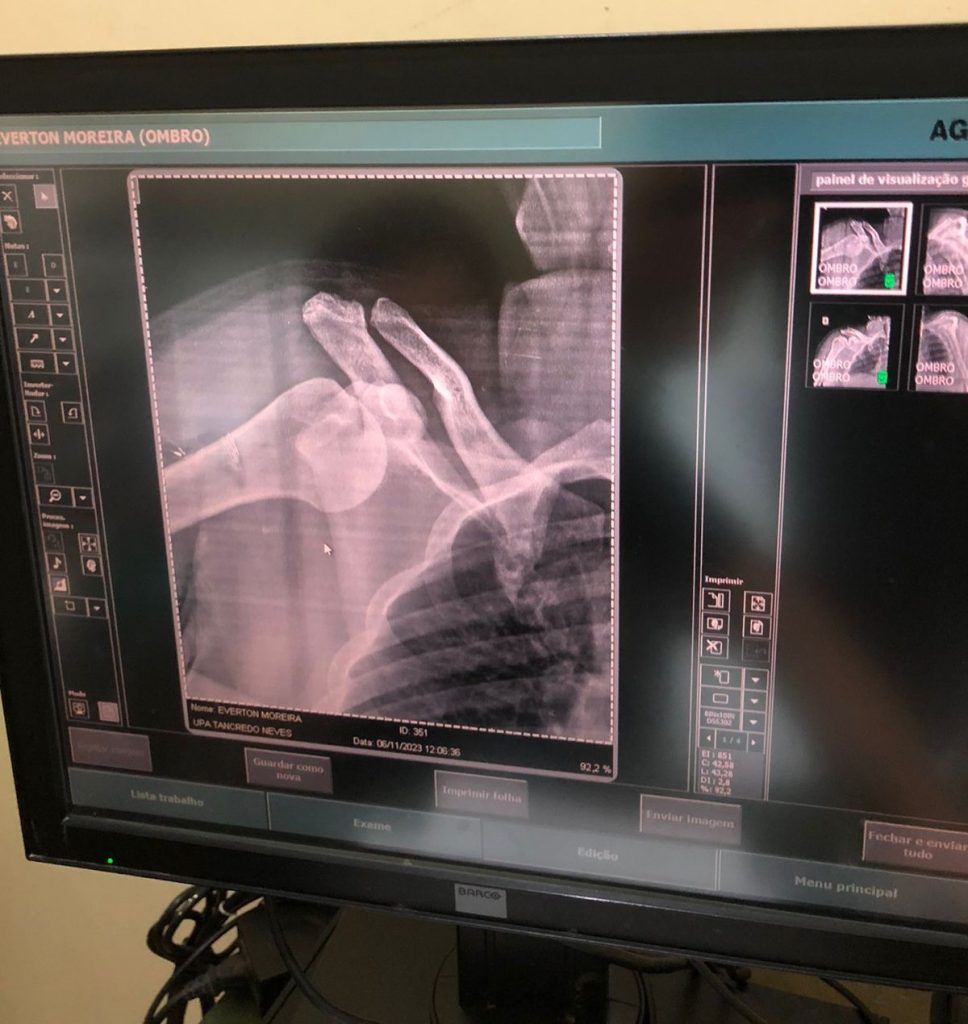 Autônomo conta com amigos e a comunidade para custear cirurgia e poder voltar a trabalhar