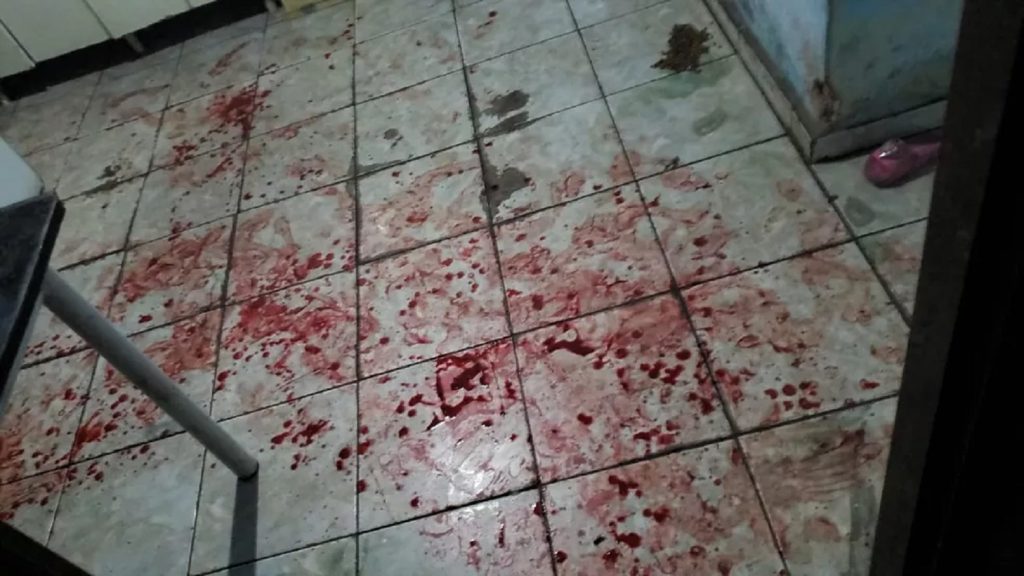 Mulher é gravemente esfaqueada no rosto e cabeça por homem na região de Goioerê