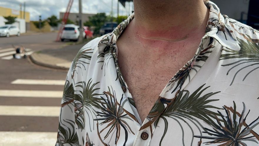 Motociclista é quase degolado por fio de telefonia solto no Interlagos