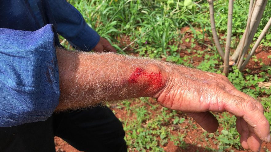 Morador do Bairro Brasília é atacado por cachorros e pede providências