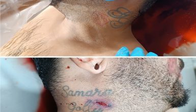 Imagem referente a Polícia divulga fotos de homem que foi baleado e arrastado em Cascavel e pede ajuda para identificá-lo