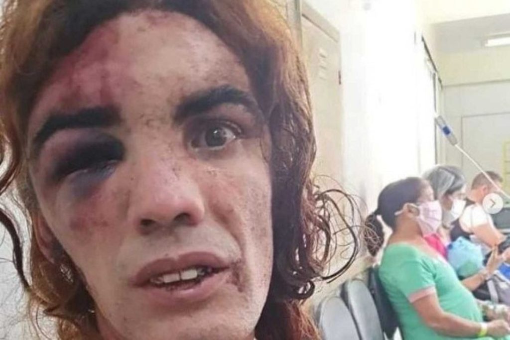 Homem que espancou mulher trans é condenado a seis meses em regime aberto